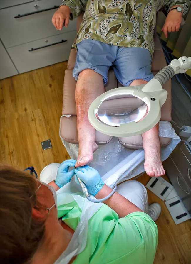 Podologikum Mauritz - Behandlung Schritt 4