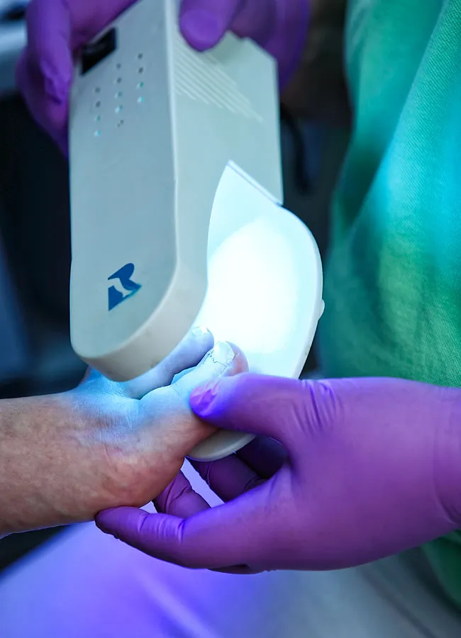 Podologikum Mauritz - Behandlung Schritt 4