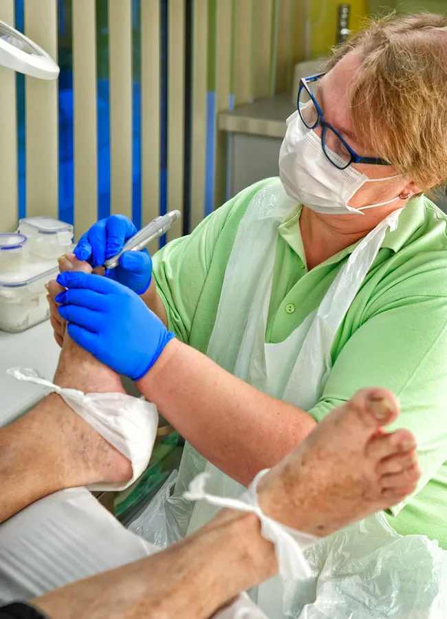 Podologikum Mauritz - Behandlung Schritt 3