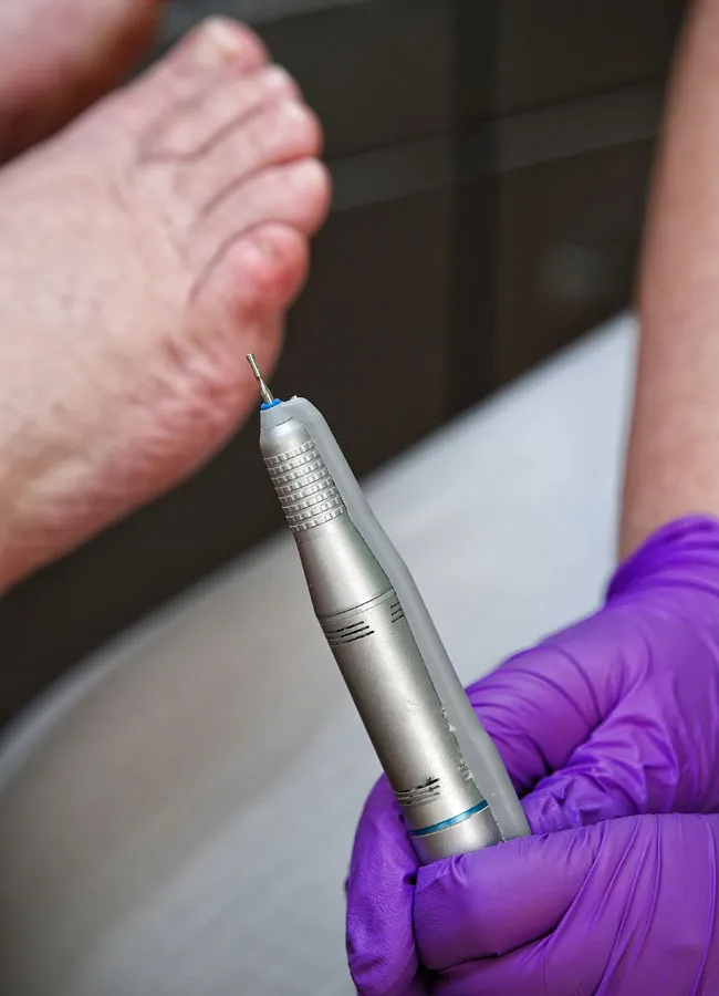 Podologikum Mauritz - Behandlung Schritt 5